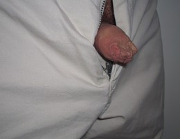 Tiny dick images Image 6