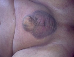 My small soft cock growing thicker pictures Image 4