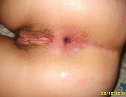 Closeup vagina and anal collection Image 1